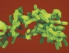 Legionella pneumophylis (Legionela)